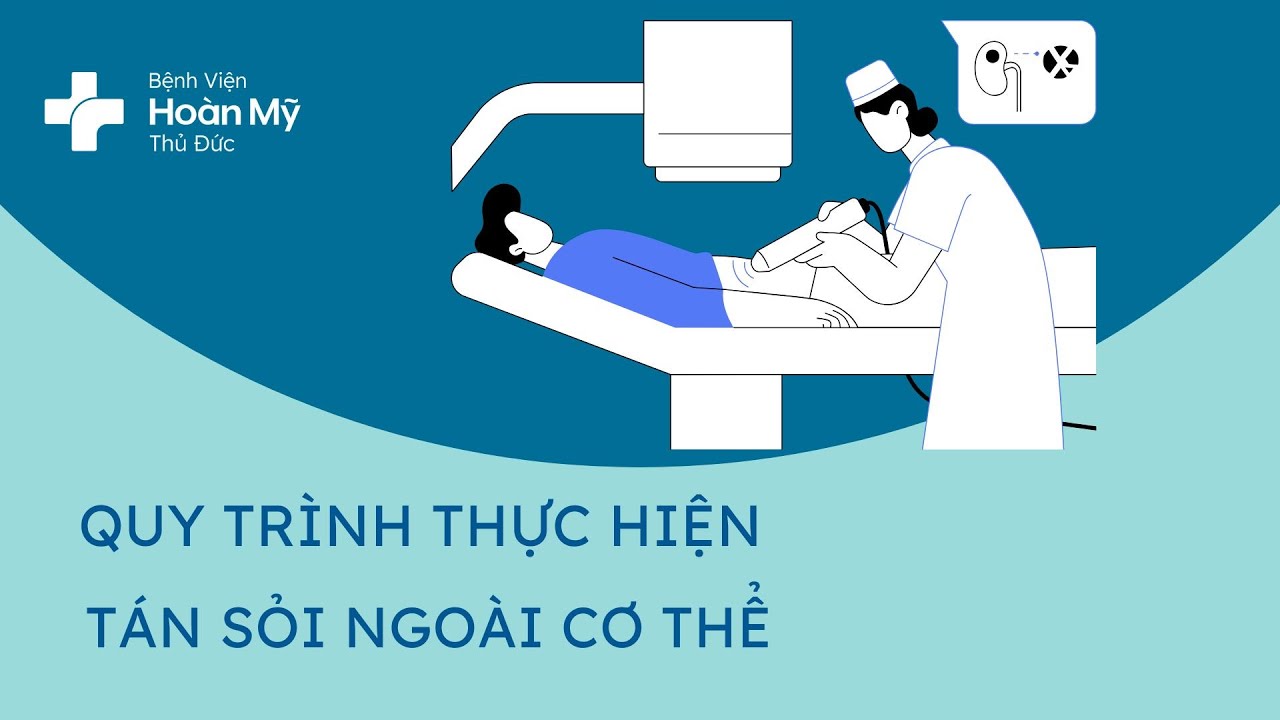 Quy trình tán sỏi ngoài cơ thể | BV Hoàn Mỹ Thủ Đức
