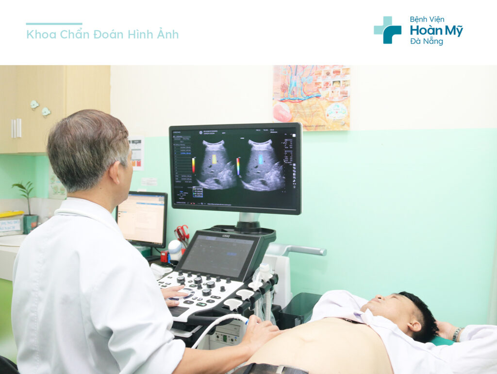Siêu âm đàn hồi mô 2D-SWE trong chẩn đoán độ xơ hoá gan ở người bệnh viêm gan mạn tính