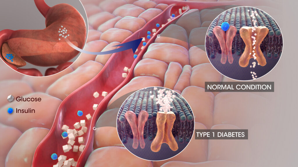 Insulin có stacs dụng gì?