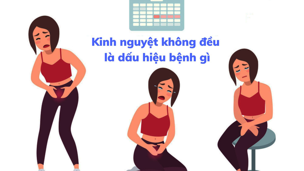 Kinh nguyệt không đều: Nguyên nhân và phương án điều trị
