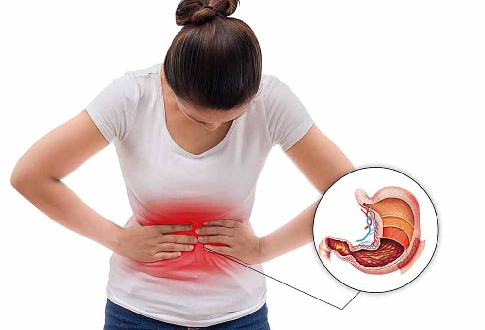 Công dụng của thuốc Misoprostol