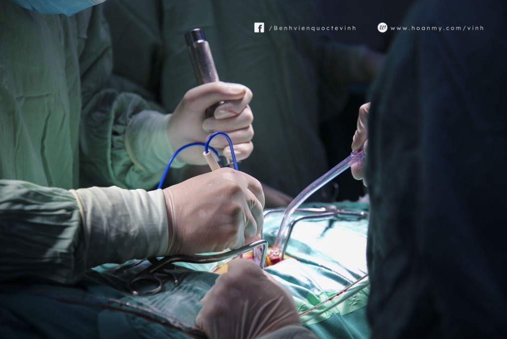 Phẫu thuật lấy khối thoát vị đĩa đệm giúp người bệnh hồi phục nhanh chóng