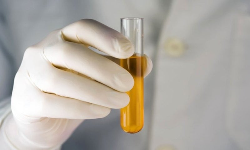 Lưu ý khi sử dụng thuốc Atorvastatin: xét nghiệm gan, lipid trước khi sử dụng, cân nhắc dùng trên 65 tuổi