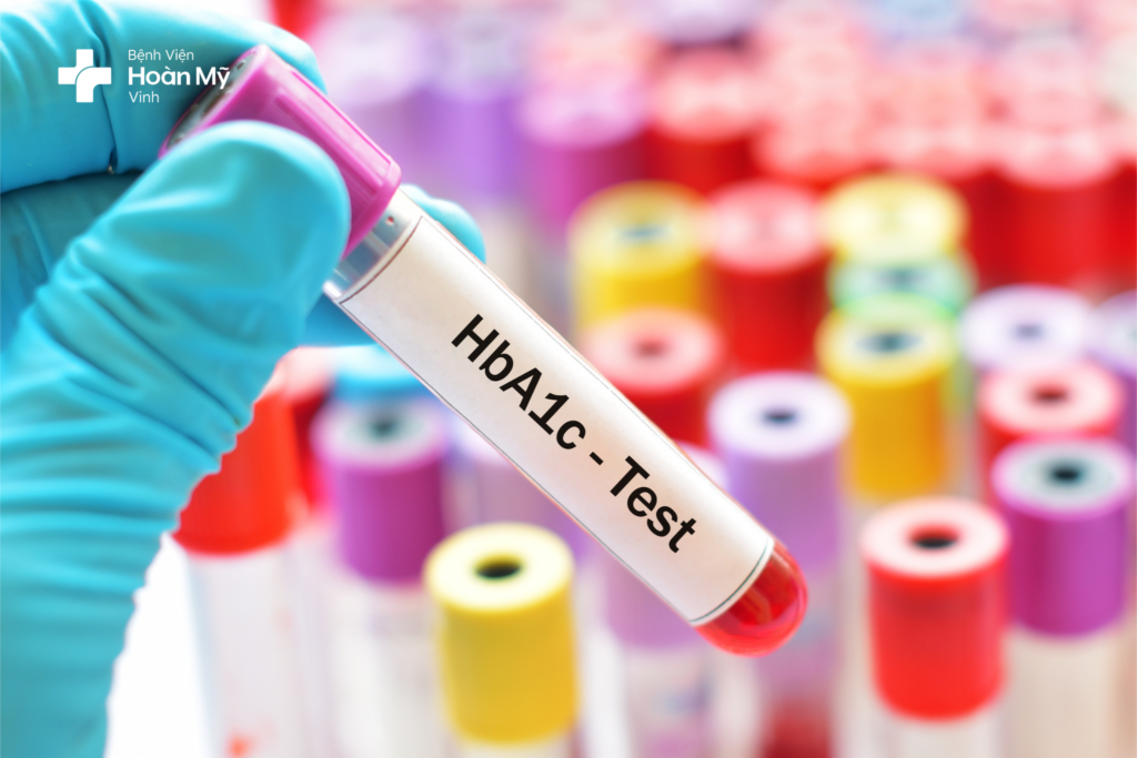 Vai trò của xét nghiệm HbA1c đối với bệnh đái tháo đường