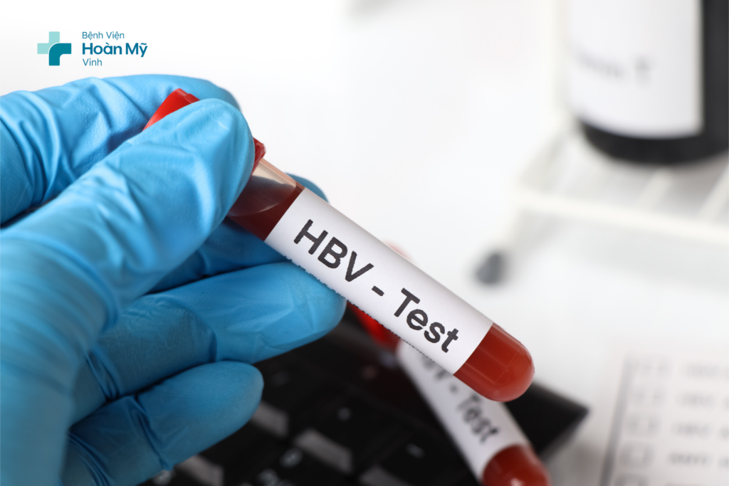 Ý nghĩa của xét nghiệm HBV-DNA trong chẩn đoán, theo dõi và điều trị viêm gan B