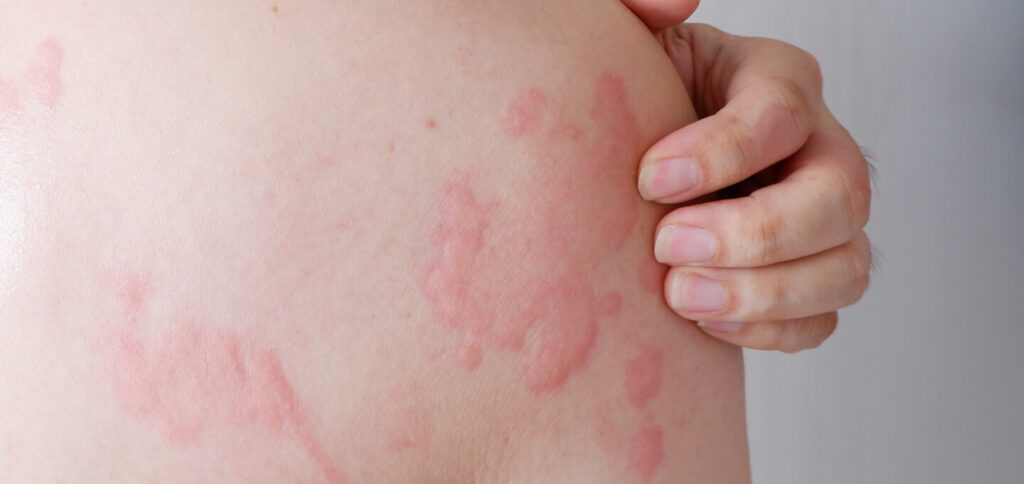 Lưu ý quan trọng khi sử dụng cây đuôi chuột là thuốc trị bệnh