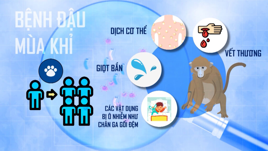 Thuốc điều trị đậu mùa khỉ có những loại nào? Hiệu quả của từng loại