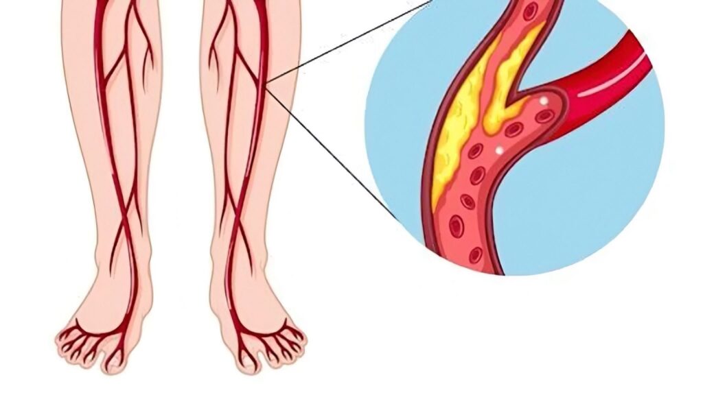 Biến động mạch ngoại biên