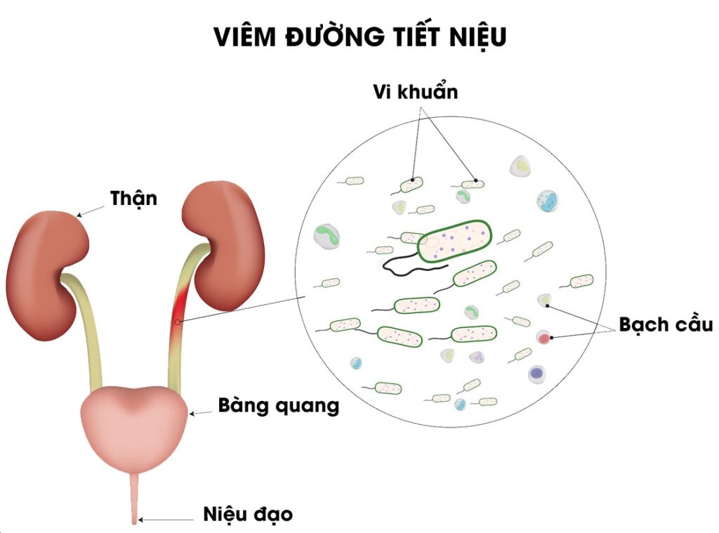 Biểu hiện taiij chỗ