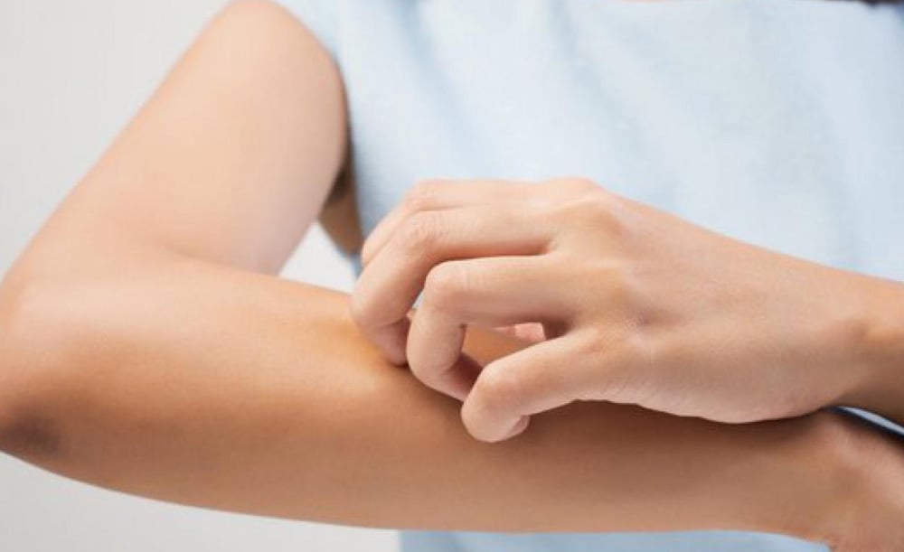 Thuốc Cetirizin: Công dụng, chỉ định, lưu ý sử dụng
