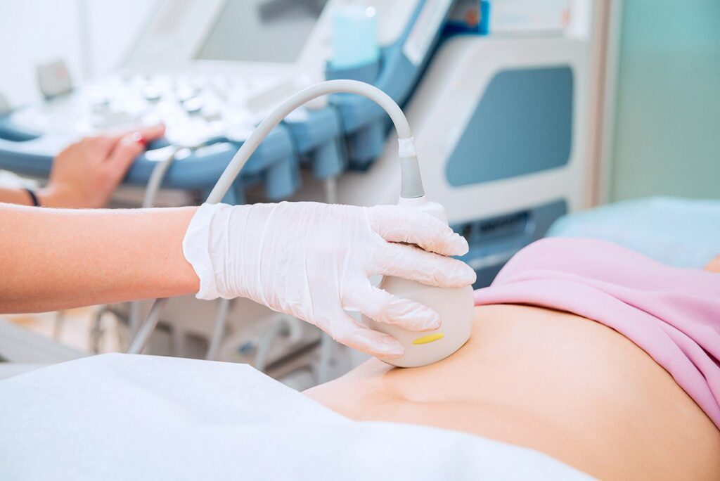 Siêu âm là một trong các phương pháp chẩn đoán u xơ