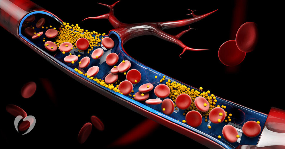 Cholesterol là chất béo quan trọng đối với sự phát triển của cơ thể