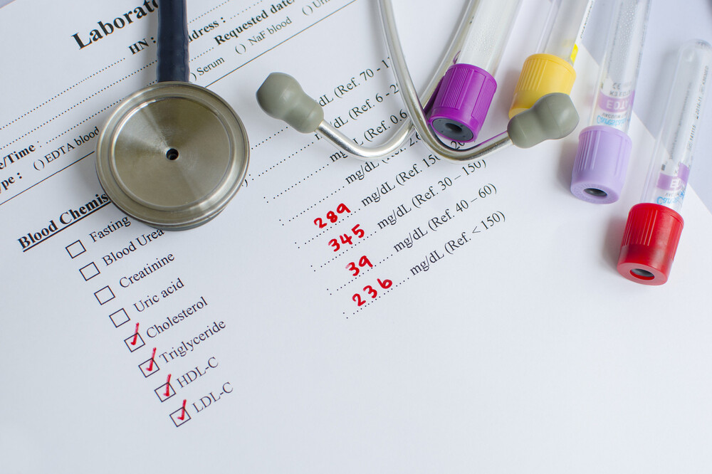 Các loại cholesterol có trong máu