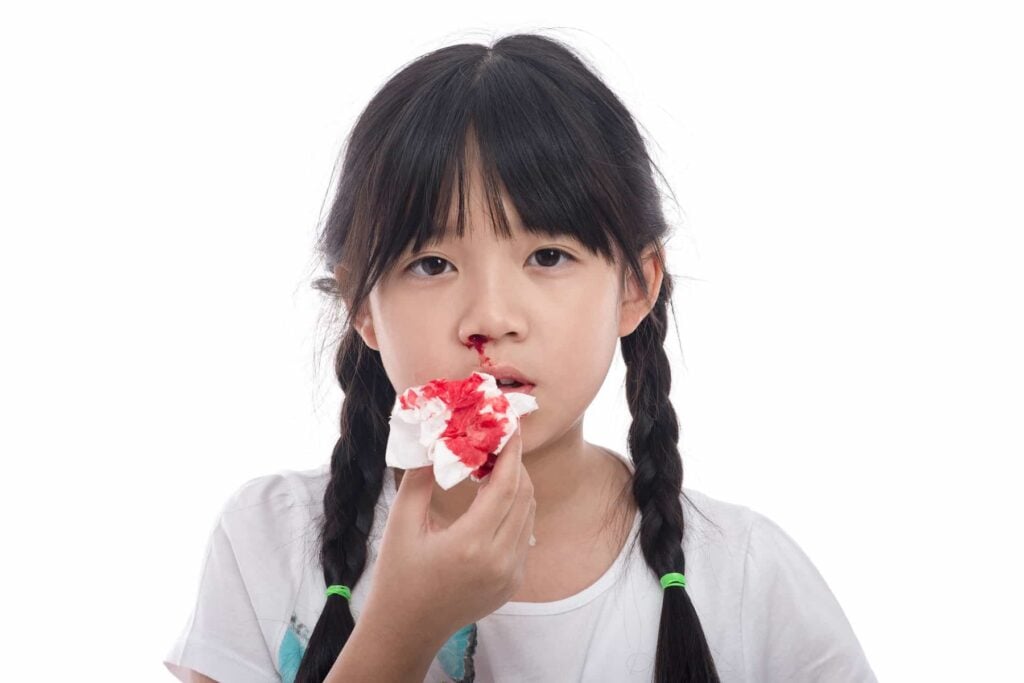 Cỏ mực có khả năng trị chứng chảy máu cam 