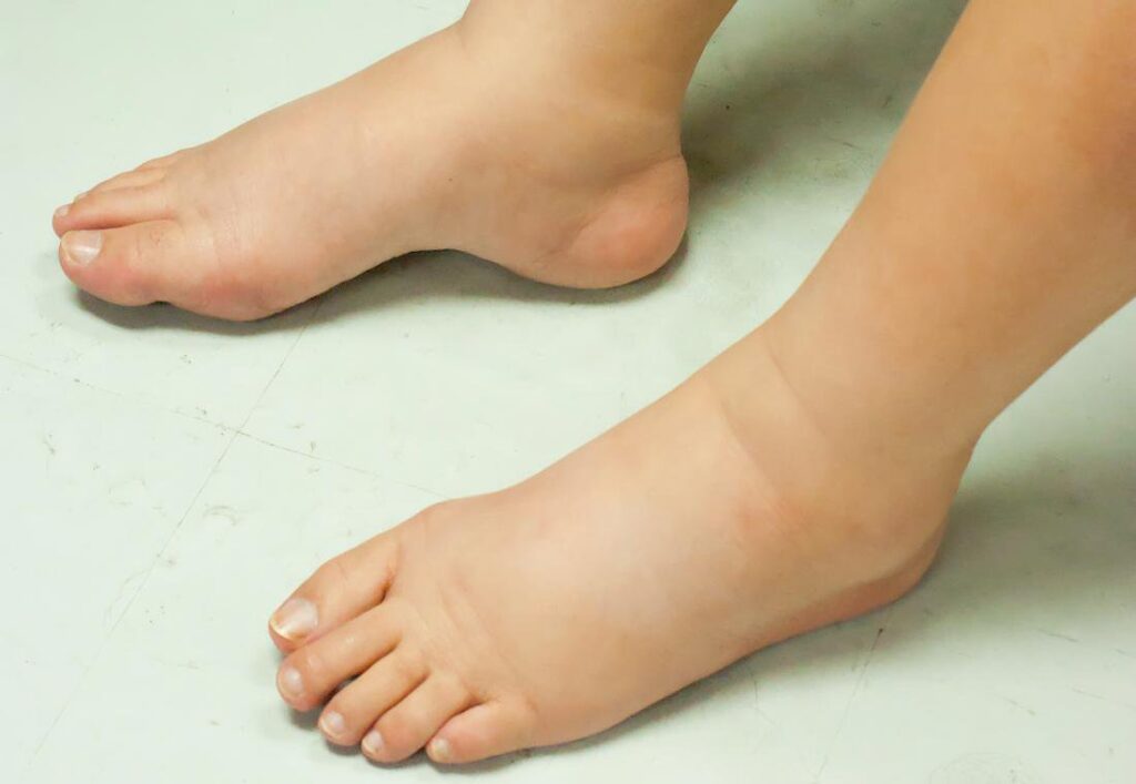 Thuốc có tác dụng giảm phù nề và kháng viêm