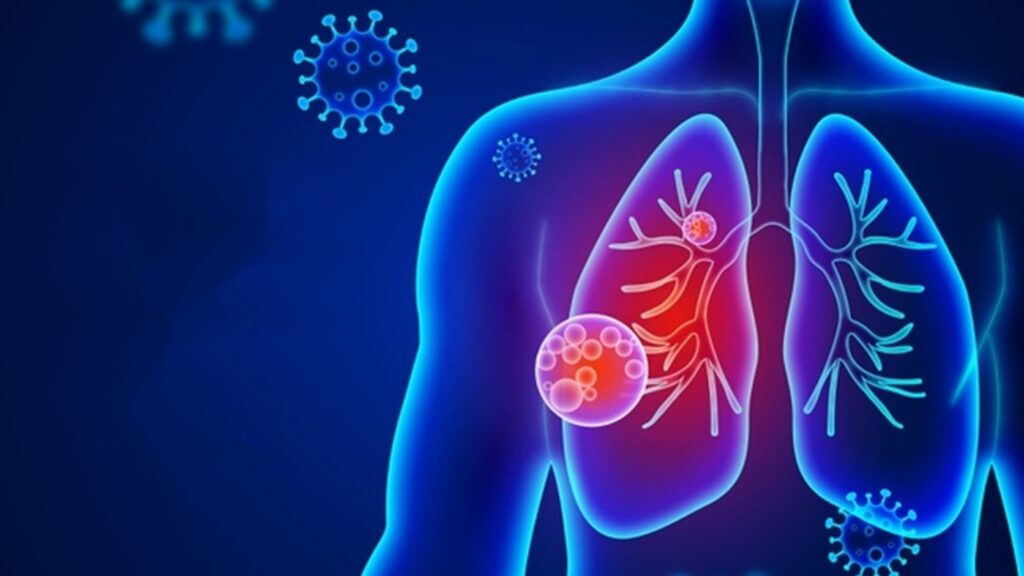 Công dụng của thuốc Augmentin