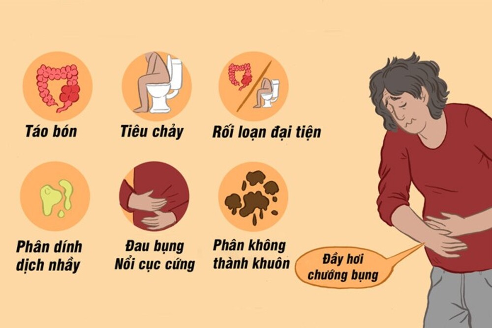 Dấu hiệu của hội chứng ruột kích thích