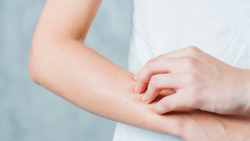 Dị ứng thức ăn: Nguyên nhân, dấu hiệu, cách phòng ngừa và xử lý