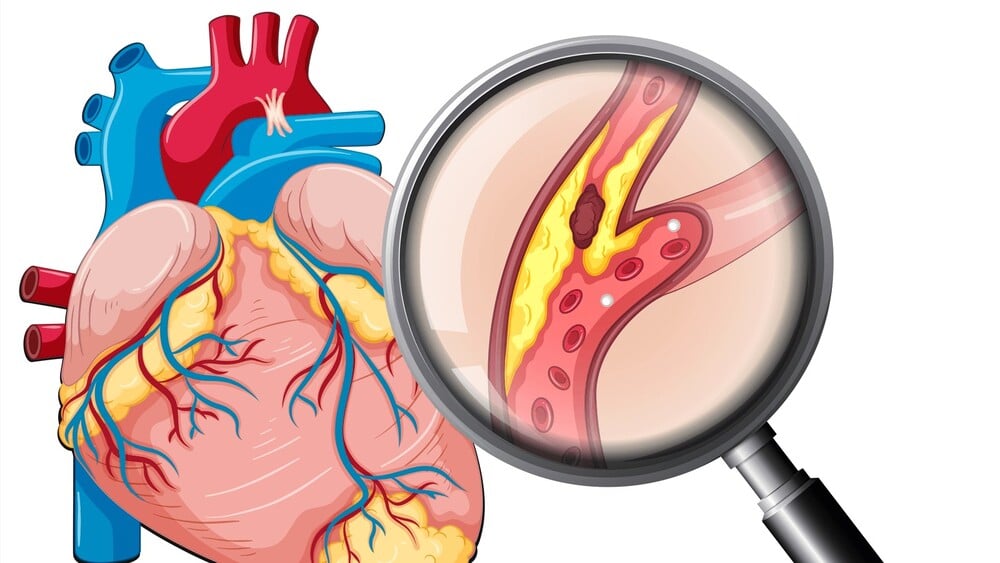 Cách sử dụng thuốc diclofenac đúng cách, hiệu quả và an toàn