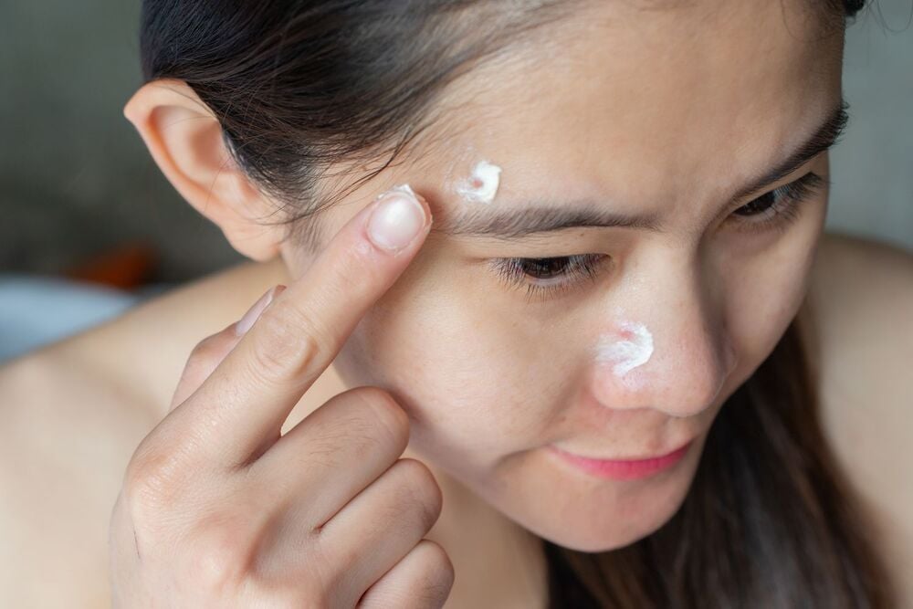 Trị mụn theo hướng dẫn của bác sĩ