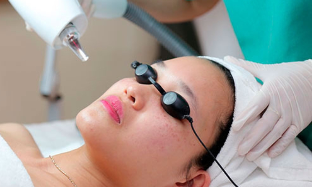 Sử dụng laser là phương pháp điều trị nám khá hiệu quả 