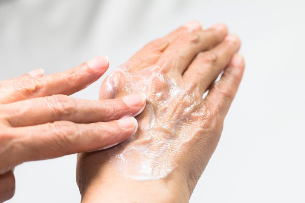 Cách điều trị viêm da cơ địa