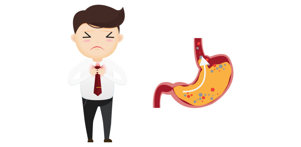 Thuốc Gaviscon: Công dụng trị trào ngược dạ dày và liều dùng