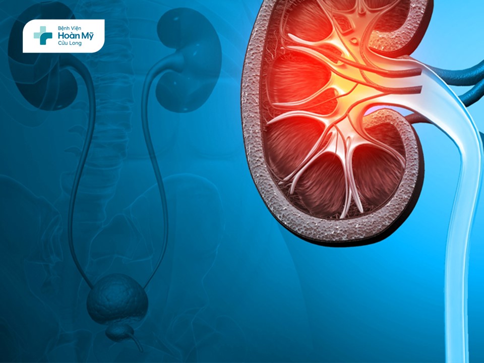 Những vấn đề cần biết về khối u hệ tiết niệu