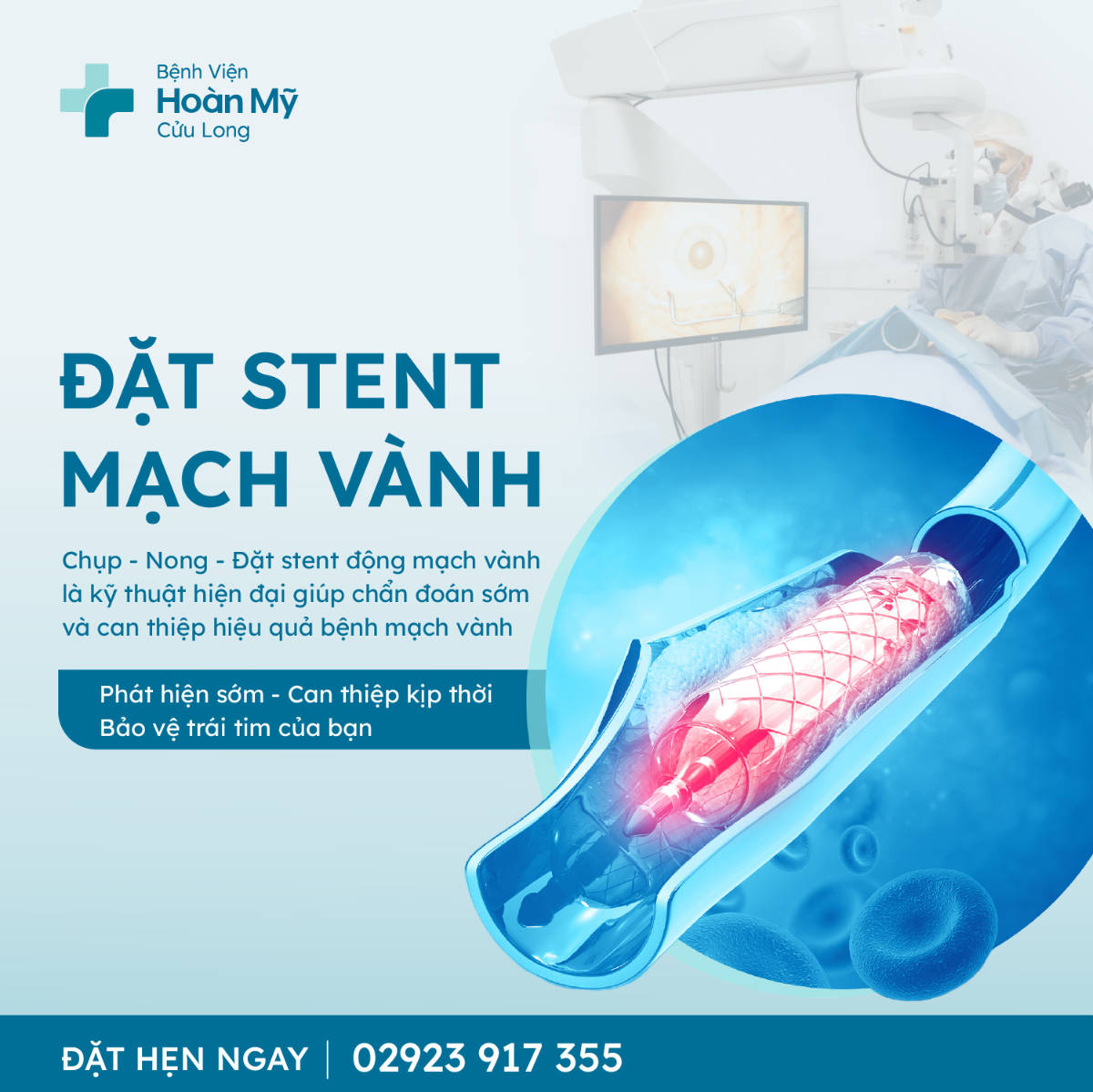 Gói đặt stent
