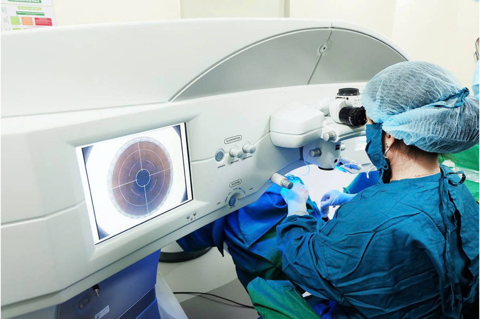 Gói phẫu thuật Lasik Femto