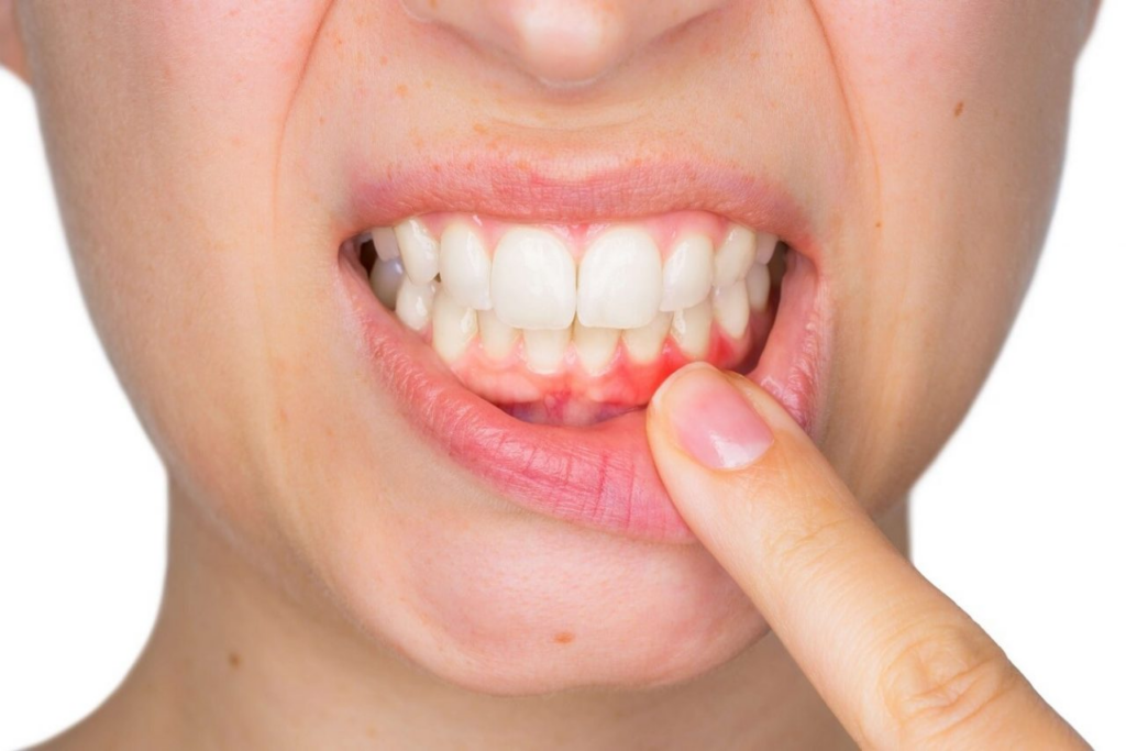 Khi nào nên lấy tủy răng