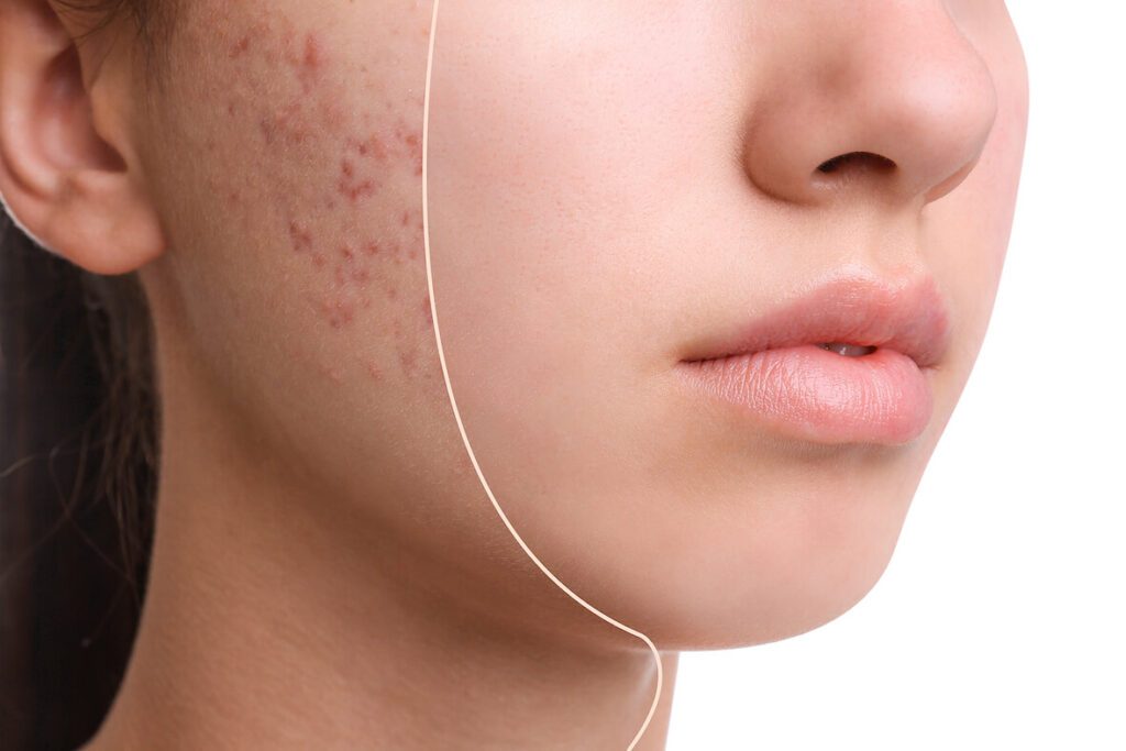 Lạm dụng quá nhiều chất tẩy rửa 