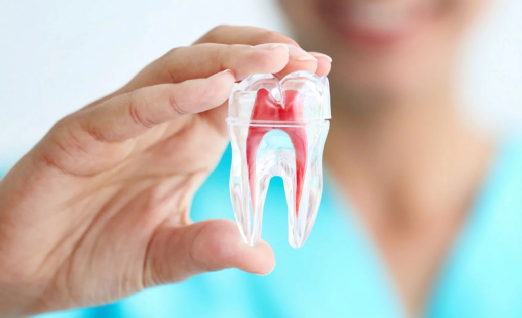 Quy trình lấy tủy răng và những thông tin cần biết