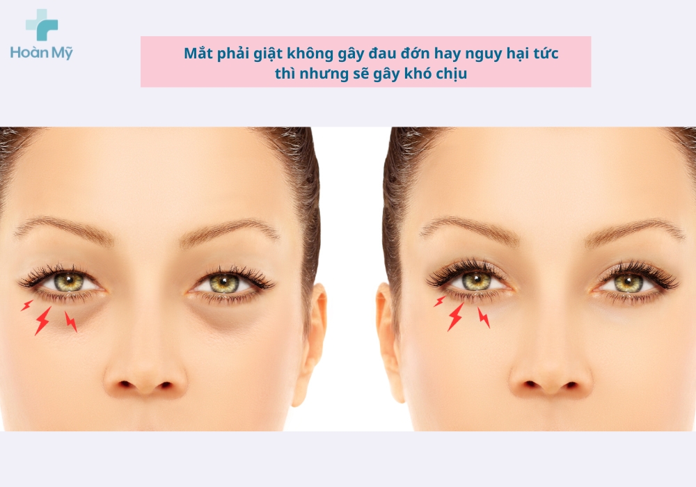 Mắt phải giật liên tục ở nam, nữ là điềm báo hay triệu chứng bệnh về mắt?