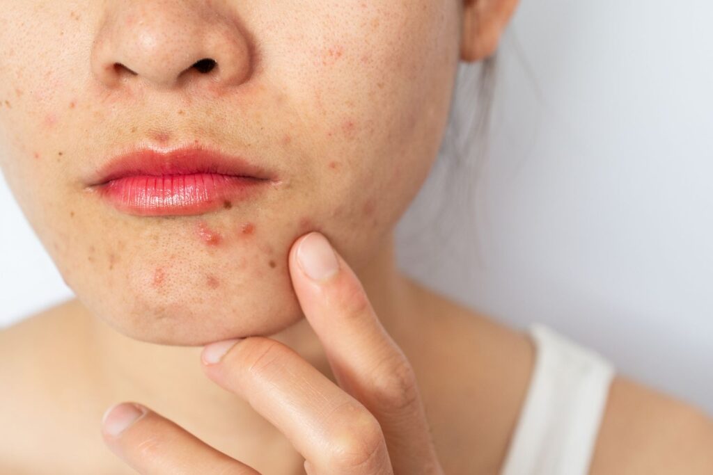 Nên thăm khám bác sĩ nếu tình trạng bệnh không giảm