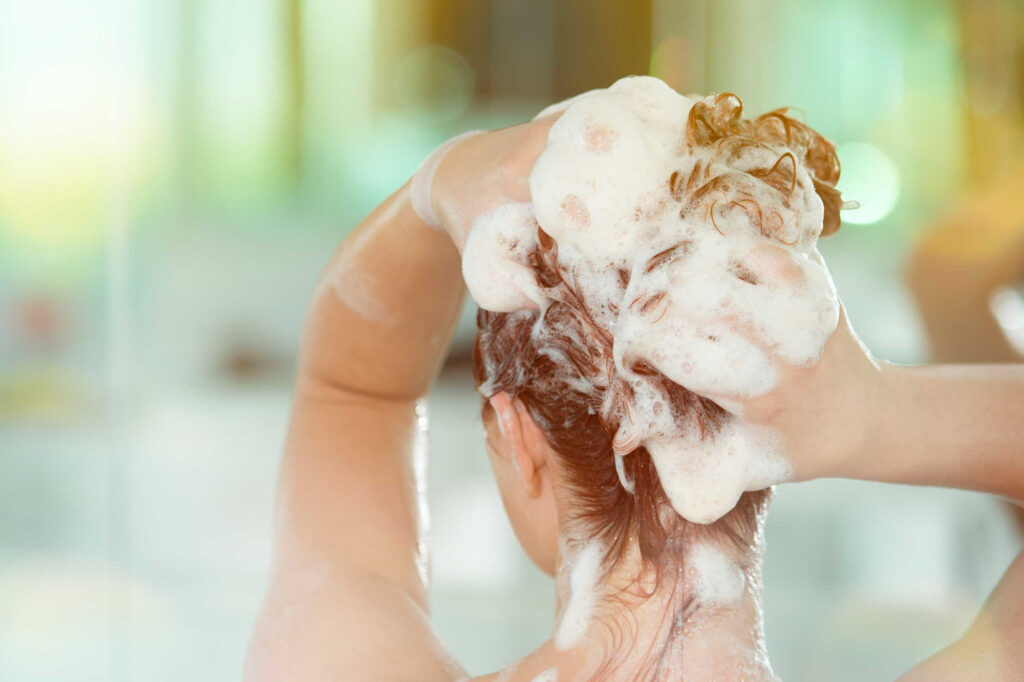 Phát ban sốt xuất huyết có thể tắm bằng nước ấm