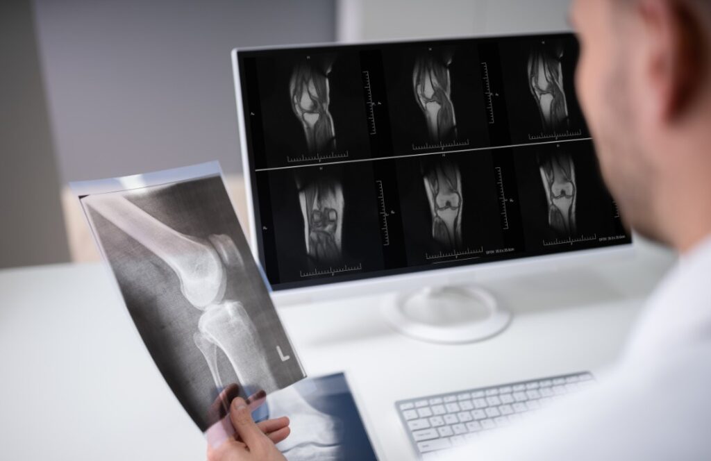 xét nghiệm chẩn đoán trước khi tiến hành thay khớp đầu gối