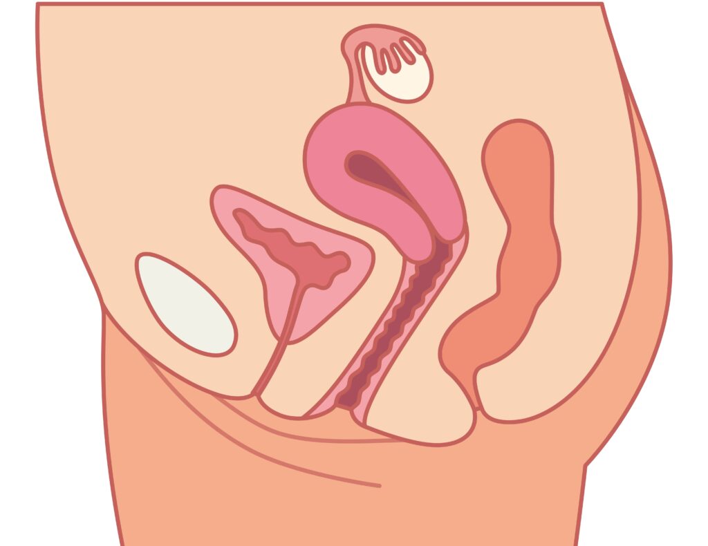 Sa tử cung: Nguyên nhân, biểu hiện và cách điều trị bệnh