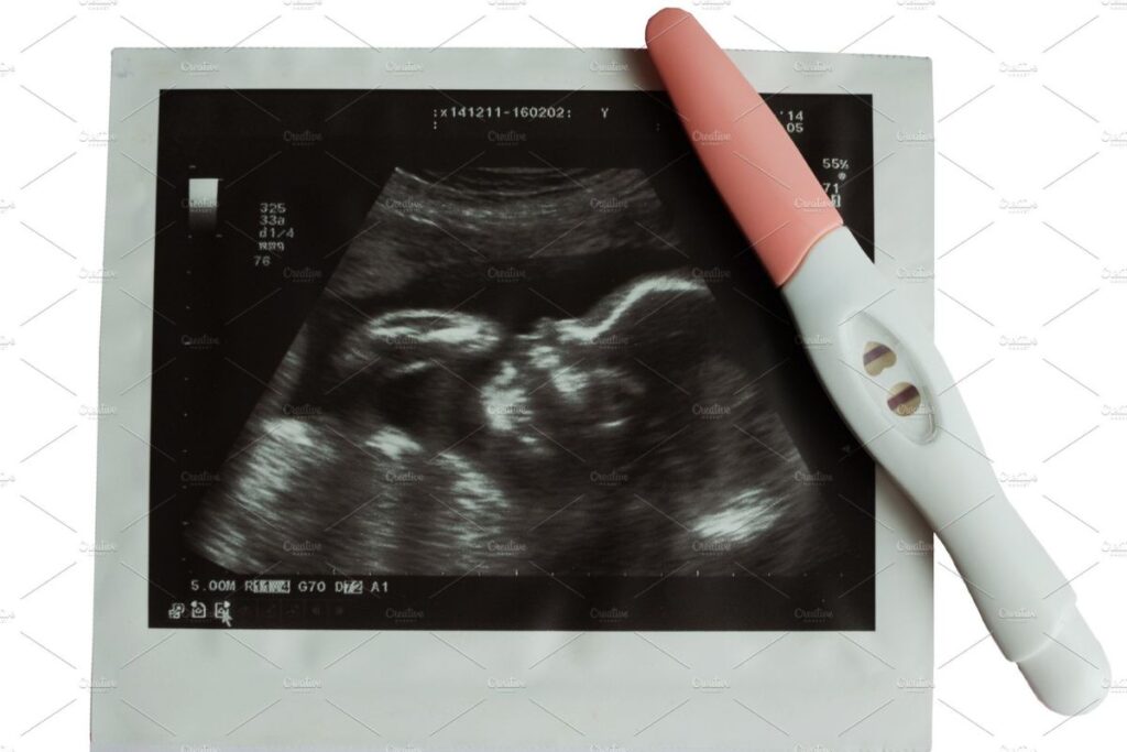 Các mốc siêu âm thai và những điều mẹ bầu cần biết trong thai kỳ
