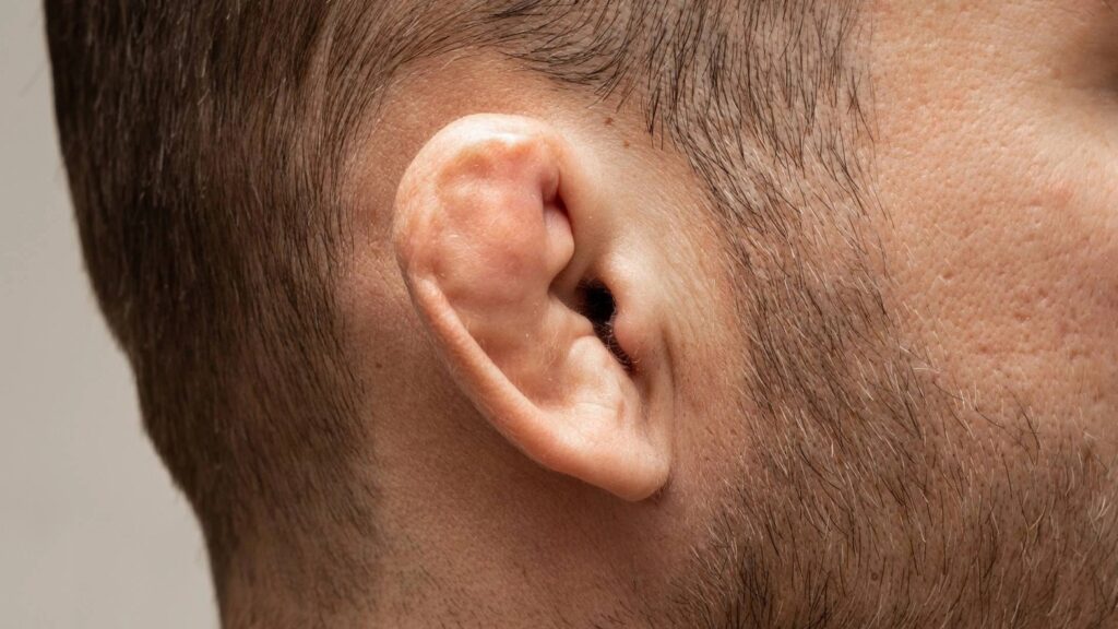 Tai súp lơ là gì? Nguyên nhân, dấu hiệu và phương pháp điều trị