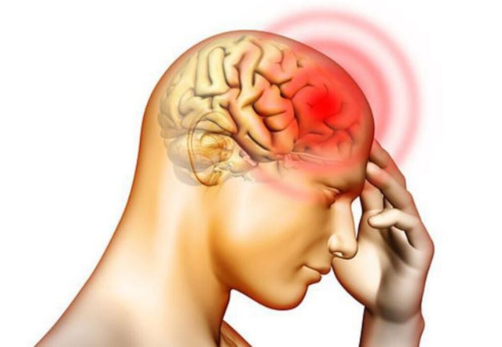 Thiếu máu não là gì? Nguyên nhân, triệu chứng và cách cải thiện bệnh