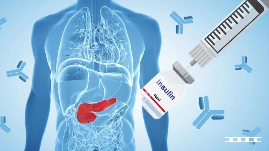 Trà xanh còn hỗ trợ điều trị bệnh đái tháo đường 