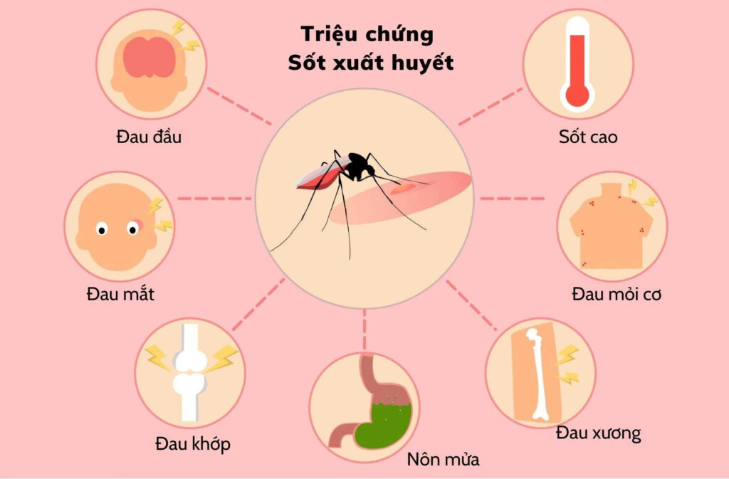 Triệu chứng sốt xuất huyết 