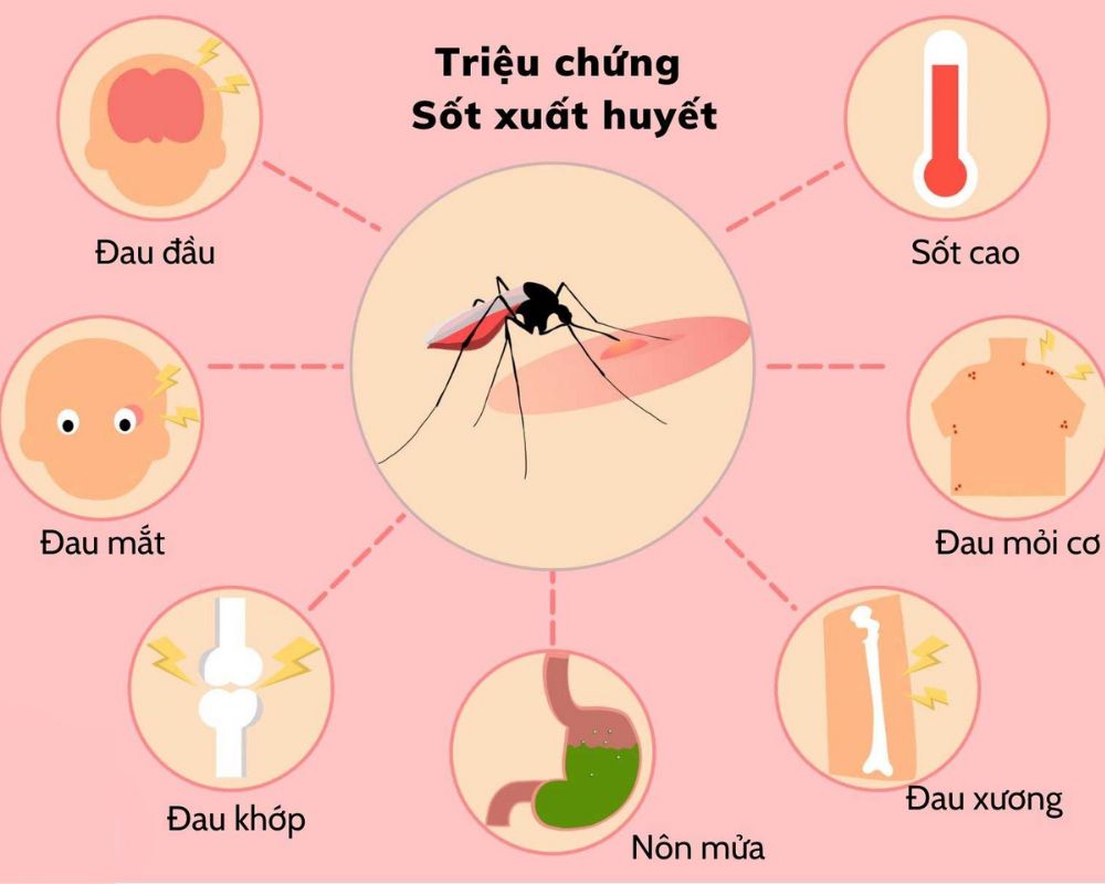 Triệu chứng của bệnh sốt xuất huyết