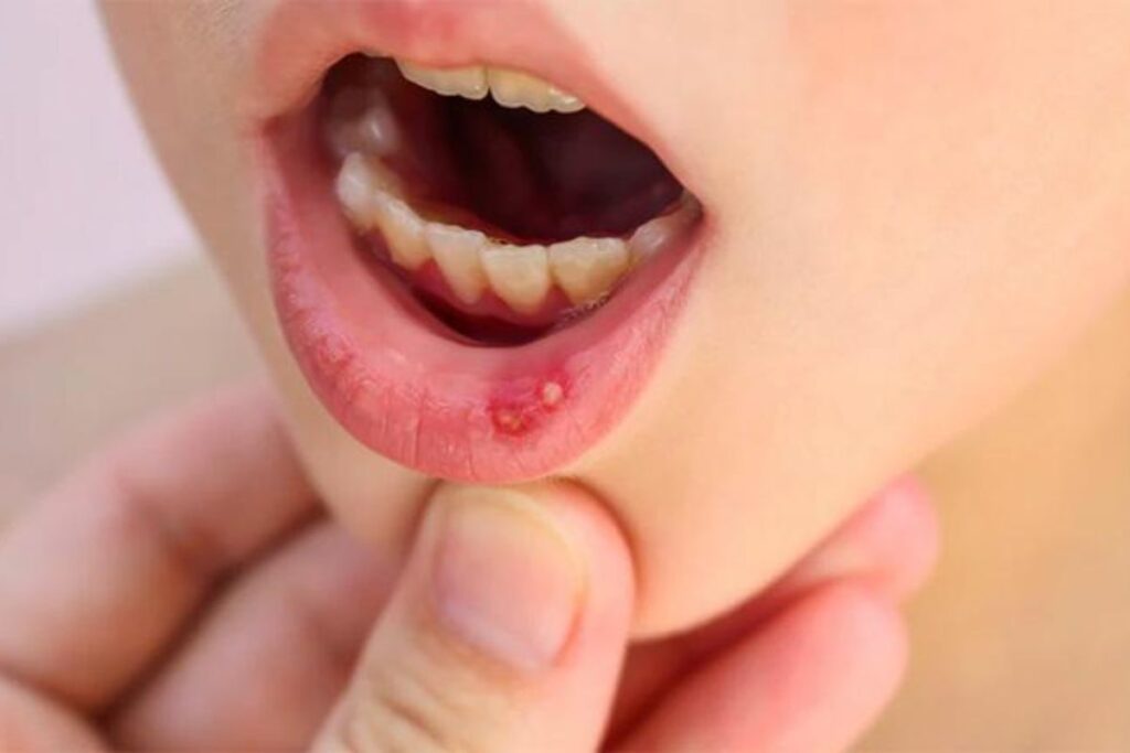 Vấn đề răng miệng