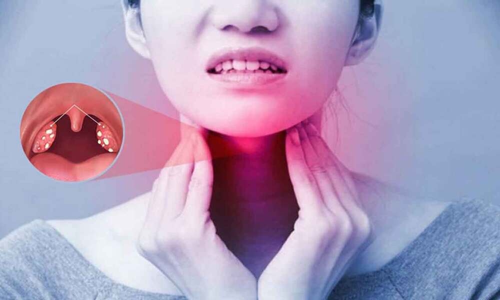 Dấu hiệu nhận biết viêm amidan hốc mủ