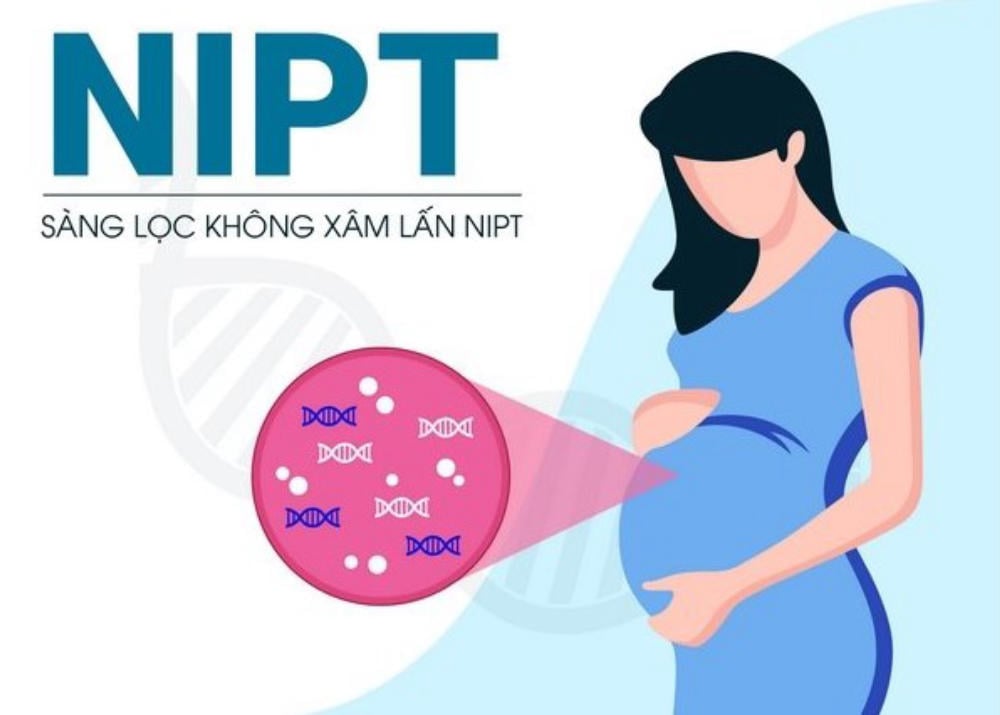 Xét nghiệm NIPT là gì? Những điều cần biết về xét nghiệm NIPT